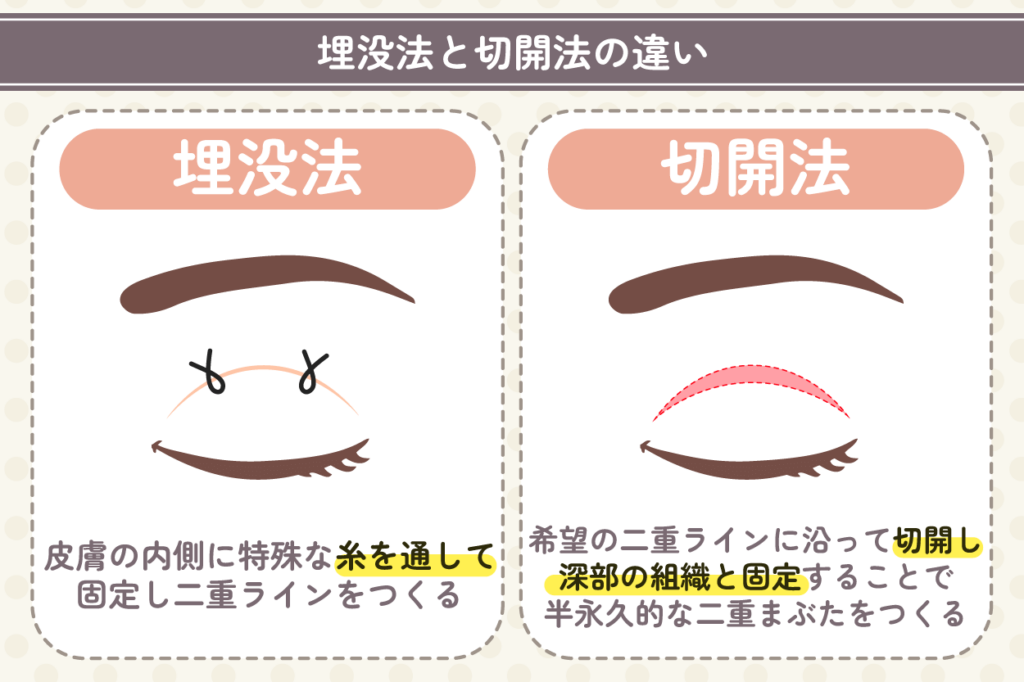 埋没法と切開法の違いは？特徴と費用相場を解説